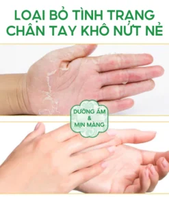 Kem Bôi Nấm Ngứa ZUDAIFU Hỗ Trợ Dứt Điểm Hắc Lào, Ghẻ Nước, Nấm Da Đầu, Vảy Nến Cực Kì Hiệu Quả 13 viemda6