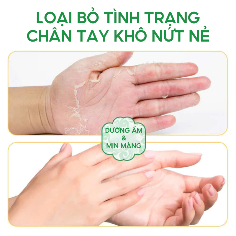 Kem Bôi Nấm Ngứa ZUDAIFU Hỗ Trợ Dứt Điểm Hắc Lào, Ghẻ Nước, Nấm Da Đầu, Vảy Nến Cực Kì Hiệu Quả 14 viemda6