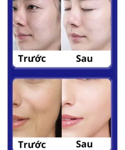 Kem UCM xóa nám, tàn nhang, trẻ hóa làn da Nội địa 10 xoanhan3 1