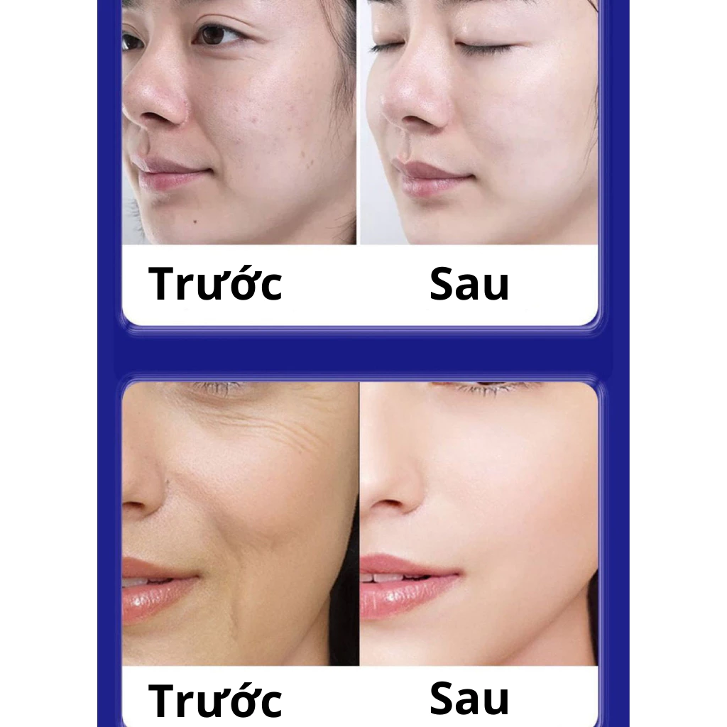 Kem UCM xóa nhăn, mờ nám trẻ hóa làn da nội địa nhật 23