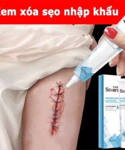 Alternative view of kem xóa sẹo loại bỏ hiệu quả các vết sẹo cũ sẹo phẫu thuật làm sáng các vết rạn da loại bỏ sẹo mụn trứng cá