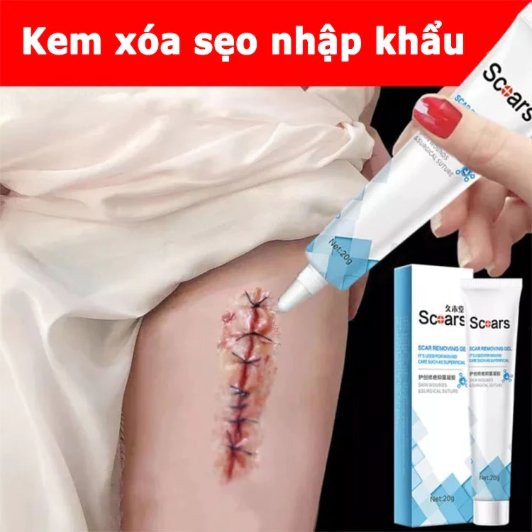 kem xóa sẹo loại bỏ hiệu quả các vết sẹo cũ sẹo phẫu thuật làm sáng các vết rạn da loại bỏ sẹo mụn trứng cá 1 kem xóa sẹo loại bỏ hiệu quả các vết sẹo cũ sẹo phẫu thuật làm sáng các vết rạn da loại bỏ sẹo mụn trứng cá