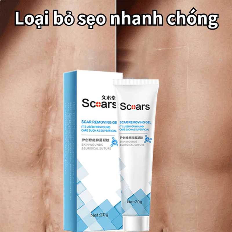 kem xóa sẹo loại bỏ hiệu quả các vết sẹo cũ sẹo phẫu thuật làm sáng các vết rạn da loại bỏ sẹo mụn trứng cá 25
