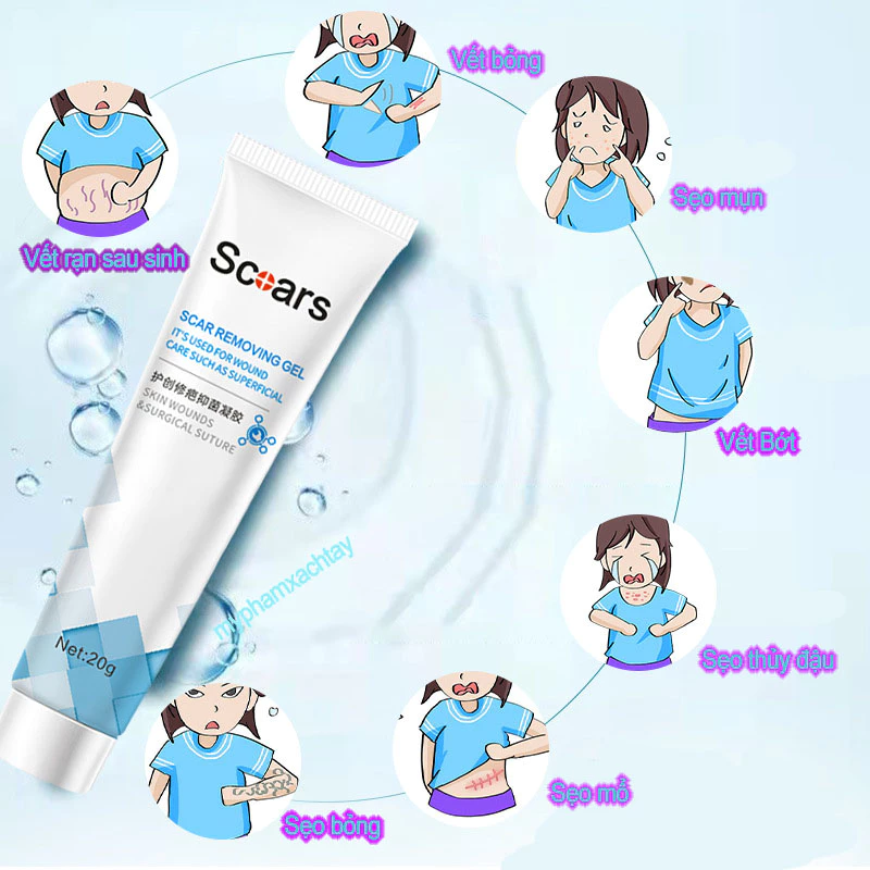 kem xóa sẹo loại bỏ hiệu quả các vết sẹo cũ sẹo phẫu thuật làm sáng các vết rạn da loại bỏ sẹo mụn trứng cá 20