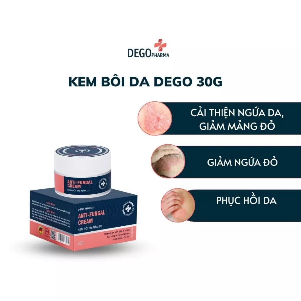 Kem bôi da Dego 30g hỗ trợ cải thiện ngứa đỏ da 26 dego1