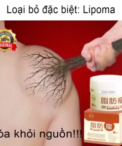 Kem loại bỏ u mỡ tan u mỡ Kem lipoma Loại bỏ mỡ dưới da 30g Tinh chất thảo mộc tự nhiên Giảm đau thần kinh gân khớp