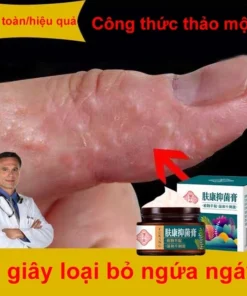 Kem chống ngứa kem kháng khuẩn chống dị ứng khỏi tận gốc viêm da bệnh chàm Ngứa da nấm da nấm mụn nước tổ đỉa 30g