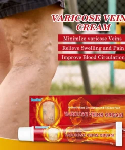 Alternative view of [ Có sẵn ] Kem bôi giãn tĩnh mạch Sumifun [ Cực hiệu quả ]