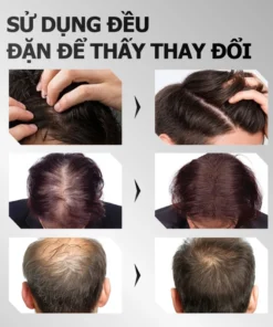 Greenvibes Xịt tinh chất mọc tóc thúc đẩy tóc đen mọc dài hỗ trợ chuyển tóc bạc thành tóc đen 16 greevev6