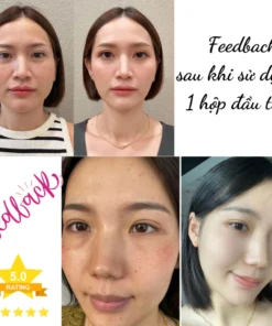 Kem Nám Tàn Nhang Nhân Sâm CNXUER Hộp 60g Kem Mờ Thâm Nám Tàn Nhang Dưỡng Ẩm Sáng Da Ngừa Lão Hóa 16 kemnam8