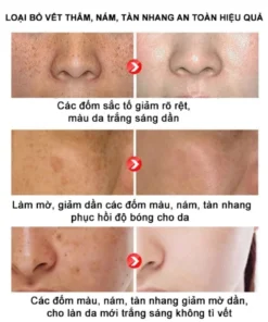 Kem Nám Tàn Nhang Nhân Sâm CNXUER Hộp 60g Kem Mờ Thâm Nám Tàn Nhang Dưỡng Ẩm Sáng Da Ngừa Lão Hóa 17 kemnam9