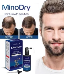 Dung dịch mọc tóc MinoDry Minoxidil 5% (DẠNG LỎNG) 13 mino6 1