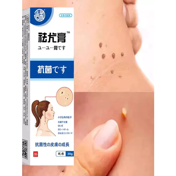 Kem bôi loại bỏ mụn thịt nhỏ trên cổ, da thừa, mụn cóc dạng sợi, mụn phẳng, mụn nhỏ ở vùng nách. 2 Kem bôi loại bỏ mụn thịt nhỏ trên cổ, da thừa, mụn cóc dạng sợi, mụn phẳng, mụn nhỏ ở vùng nách. - Ảnh 2