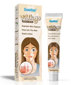 vitiligo8