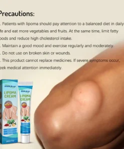 Alternative view of South Moon 20g Kem tan u mỡ Lipoma Lipolysis cho sưng da và u