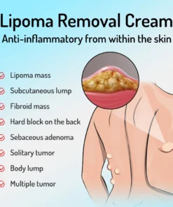 lipoma7