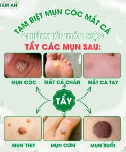 Tinh Chất Thảo Mộc NUNAMIN 15ML - Hỗ Trợ Xử Lý Mụn Cóc, Mụn Thịt, Mắt Cá Chân Tay 10 nuna2