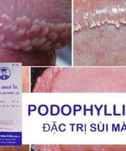 Alternative view of Thuốc Podophyllin 25 Thái Lan trị sùi mào gà hiệu quả an toàn