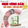 [MỤN VÙNG KÍN] Tinh Chất Hỗ Trợ Xử Lý Sùi Mào Gà, Hạt Ngọc, Mụn Li Ti 10ml (Che Tên)