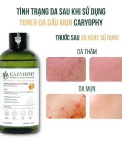 Nước cân bằng Caryophy 300ml (Caryophy Portulaca Toner 300ml)