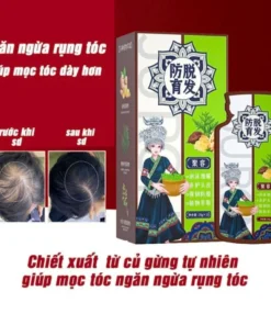 Dầu gội kích mọc tóc Gừng - Dầu gội Jucong Elbon MỘC CỬU ngăn ngừa rụng tóc, giảm hói, kích tóc con mọc nhanh chóng 10 elon1