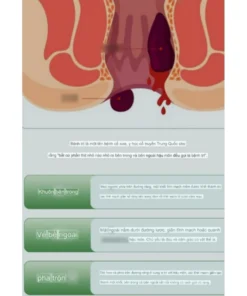 Gel Bôi Trĩ Kreain Nature Hỗ Trợ Giảm Ngứa Rát, Khô Thoáng Vùng Da Nhạy Cảm, Gel Thảo Mộc Làm Dịu Sưng Nóng Hiệu Quả 20g 18 kranboitri7
