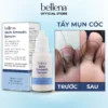 Serum chấm bôi mụn cóc mụn thịt vết chai sần Bellena Skin Smooth Serum