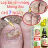 Tinh dầu nấm móng tay, nhiễm nấm móng tay, sửa chữa bệnh nấm móng tay nứt nẻ, paronychia, onychomycosis, sửa chữa móng tay mọc ngược, loại bỏ bệnh nấm móng tay