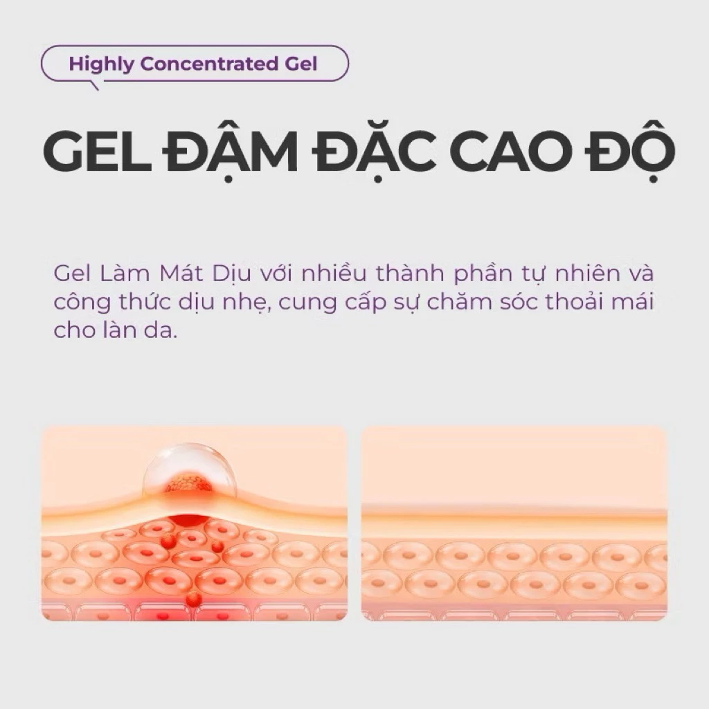Gel Bôi Trĩ Kreain Nature Hỗ Trợ Giảm Ngứa Rát, Khô Thoáng Vùng Da Nhạy Cảm, Gel Thảo Mộc Làm Dịu Sưng Nóng Hiệu Quả 20g 10 Gel Bôi Trĩ Kreain Nature Hỗ Trợ Giảm Ngứa Rát, Khô Thoáng Vùng Da Nhạy Cảm, Gel Thảo Mộc Làm Dịu Sưng Nóng Hiệu Quả 20g - Ảnh 10