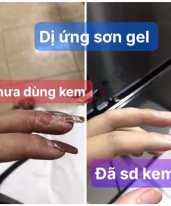 Kem bôi dị ứng Sơn gel móng tay ,lưu huynh ,nam mong ,xà phòng,hoa chất làm tóc … 13 diunggel5