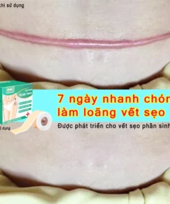 Alternative view of miếng dán sẹo Làm Mờ Sẹo Sau Phẫu Thuật Xóa Sạch Sẹo Thâm loại bỏ hiệu quả các vết sẹo lâu năm,vết thương,phỏng bô