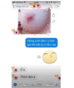 Alternative view of Kem Làm Hồng Nhũ Hoa Neipink N1 Khử Thâm Làm Hồng Vùng Kín Tự Nhiên Không Ảo