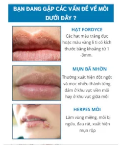 Alternative view of [CHÍNH HÃNG] Kem bôi môi hạt FORDYCE SUMIFUN dưỡng môi cải thiện môi thâm khô cứu tinh cho đôi môi