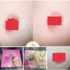Kem Làm Hồng Nhũ Hoa Hồng Bikini Giúp Nhũ Hoa Trở Nên Hồng Hào Tự Nhiên Kem Hồng Ti