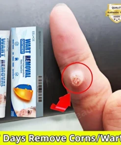 Kem Xóa Mồi Thịt/Nốt Ruồi/Mụn Cóc Chính Hãng 20g - Công Thức Thành Phần Thiên Nhiên Cho Hiệu Quả Loại Bỏ Mồi Thịt/Nốt Ruồi/Mụn