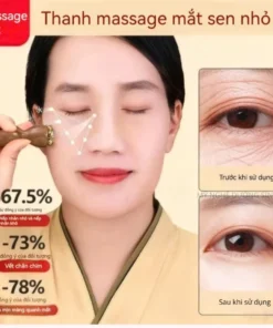 Alternative view of Con lăn massage mặt 5 hạt đồng giúp giảm bọng mắt và hỗ trợ nâng cơ trẻ hóa làn da