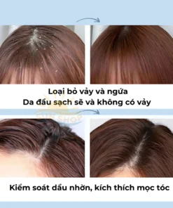 Alternative view of MAIGOOLE - Dầu Gội Chống Gầu Loại Bỏ Nấm Ngứa Da Đầu Nhật Bản, Dứt Điểm Nấm Ngứa, Viêm, Tóc Gãy Rụng Xơ Rối