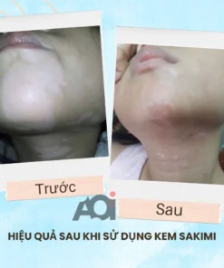 Cao Bôi Lang Ben Sakimi Cổ Truyền Nhật Bản 30ml - Loại Bỏ Đốm Trắng Lang Ben, Bạch Biến, Hắc Lào Hiệu Quả, Tái Tạo Da 14 sakimi7