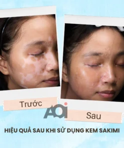 Cao Bôi Lang Ben Sakimi Cổ Truyền Nhật Bản 30ml - Loại Bỏ Đốm Trắng Lang Ben, Bạch Biến, Hắc Lào Hiệu Quả, Tái Tạo Da 15 sakimi8
