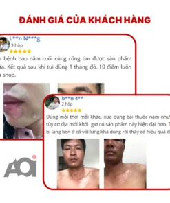 Cao Bôi Lang Ben Sakimi Cổ Truyền Nhật Bản 30ml - Loại Bỏ Đốm Trắng Lang Ben, Bạch Biến, Hắc Lào Hiệu Quả, Tái Tạo Da 16 sakimi9