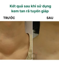 tanhachsen8